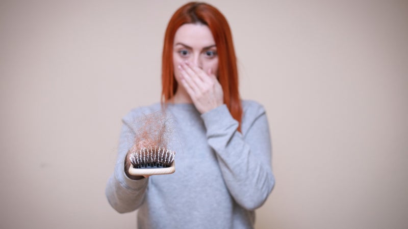 Hair Loss 4818772 1920